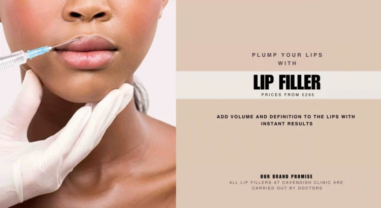 Lip-Filler-Treatments-at-Cavendish-Clinic